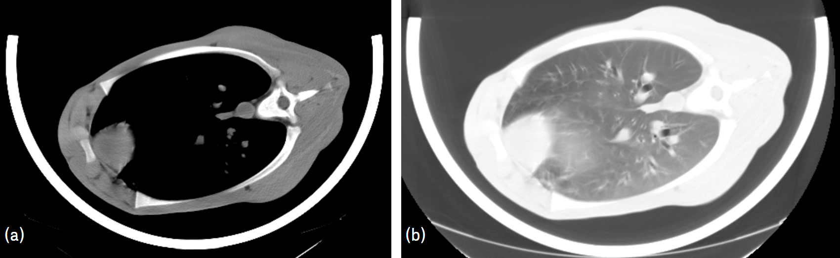 Two CT scans of a calf's thoracic region